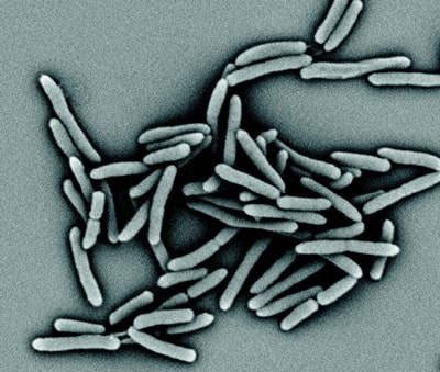 Rasterelektronenmikroskopische Aufnahme des ­Tuberkuloseerregers M.tuberculosis